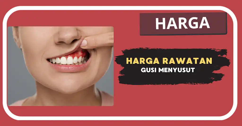 Harga Rawatan Gusi Menyusut Terkini