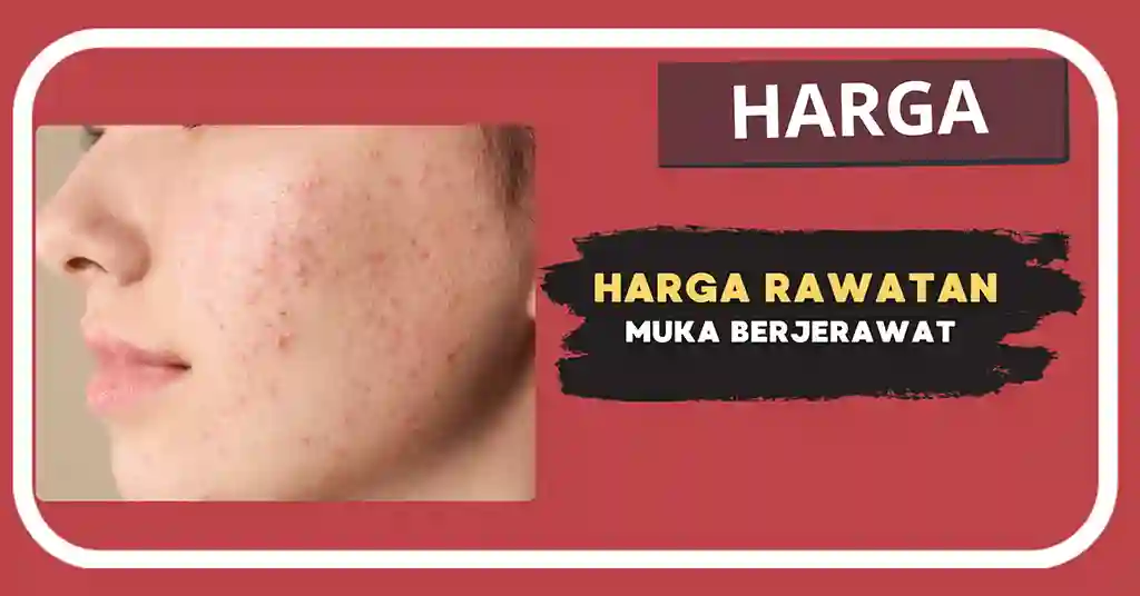 Harga Rawatan Muka Berjerawat Terkini