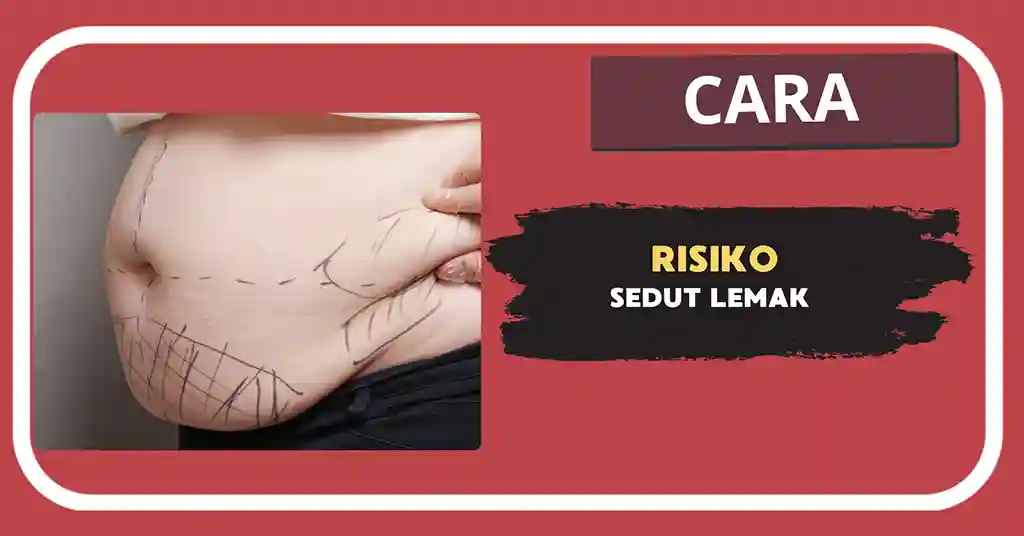 Risiko Sedut Lemak di Malaysia