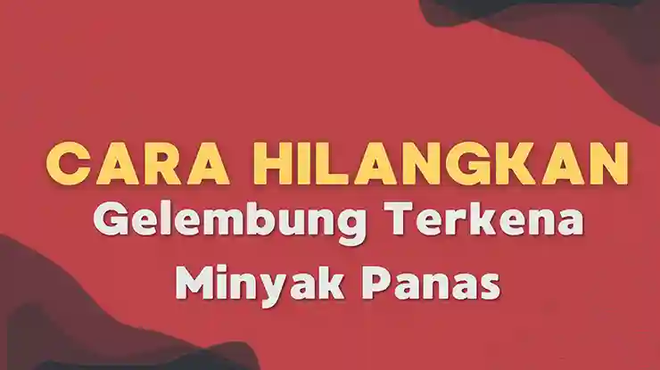 Cara Hilangkan Gelembung Terkena Minyak Panas