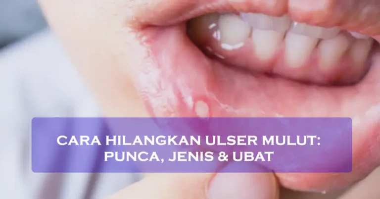 Cara Hilangkan Ulser Mulut Punca, Jenis & Ubat