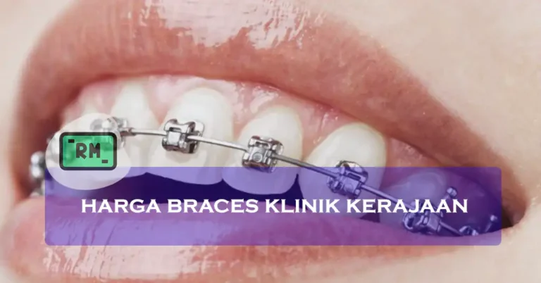 Harga Braces Klinik Kerajaan Terkini