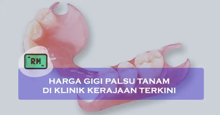 Harga Gigi Palsu Tanam Di Klinik Kerajaan Terkini