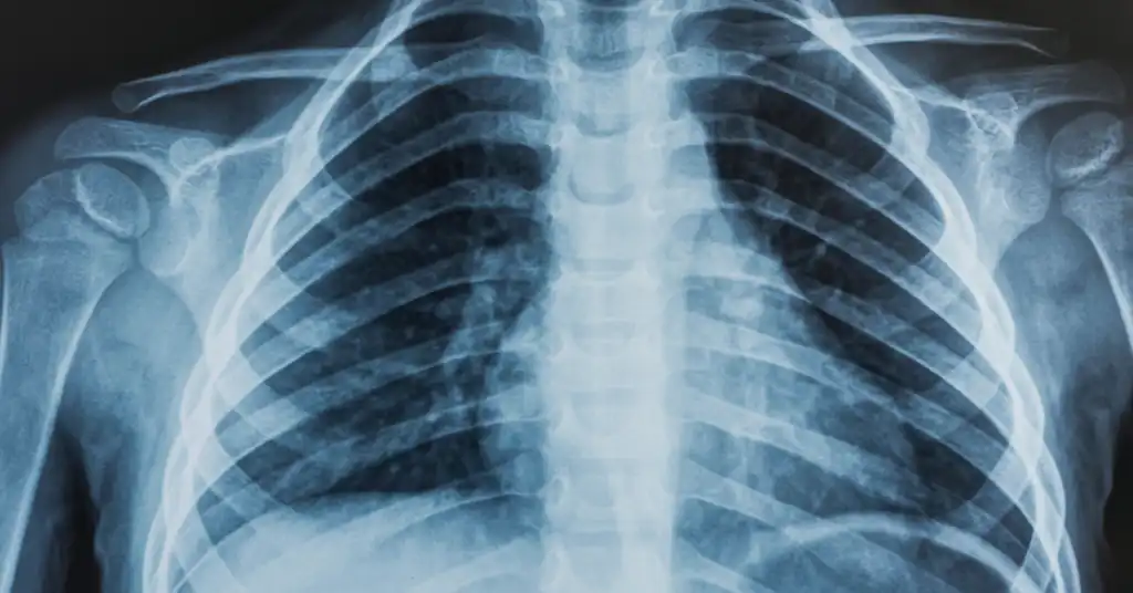 Jenis X Ray dan Kompleksiti Prosedur