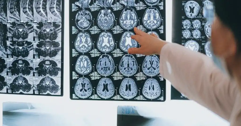 Tips Memilih Klinik Swasta untuk Pemeriksaan X Ray