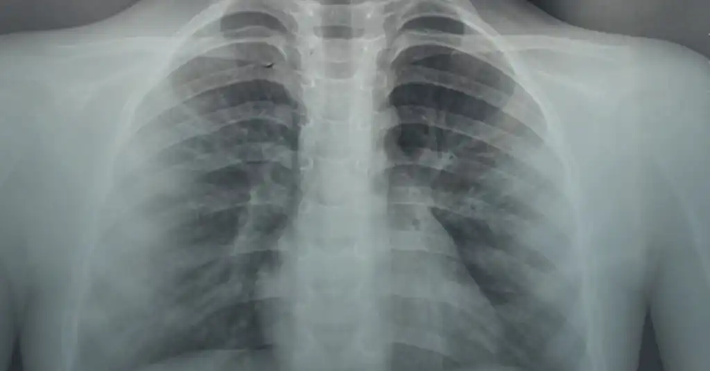 X-ray Dada
