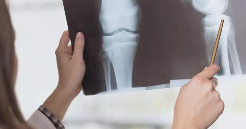 X-ray Tulang dan Sendi