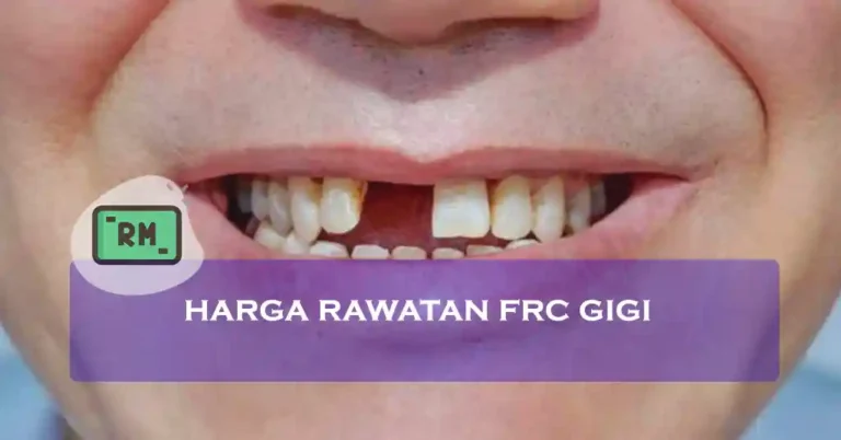 Harga Rawatan FRC Gigi