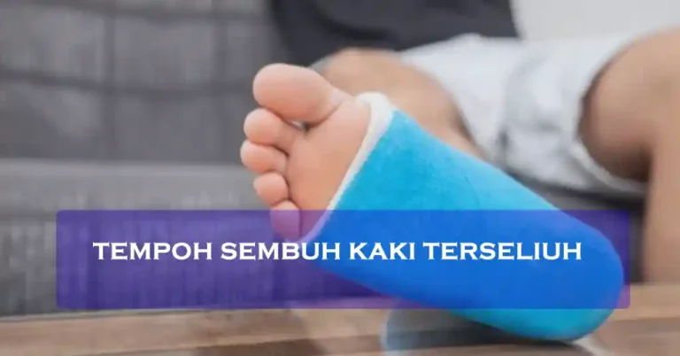 Tempoh Sembuh Kaki Terseliuh